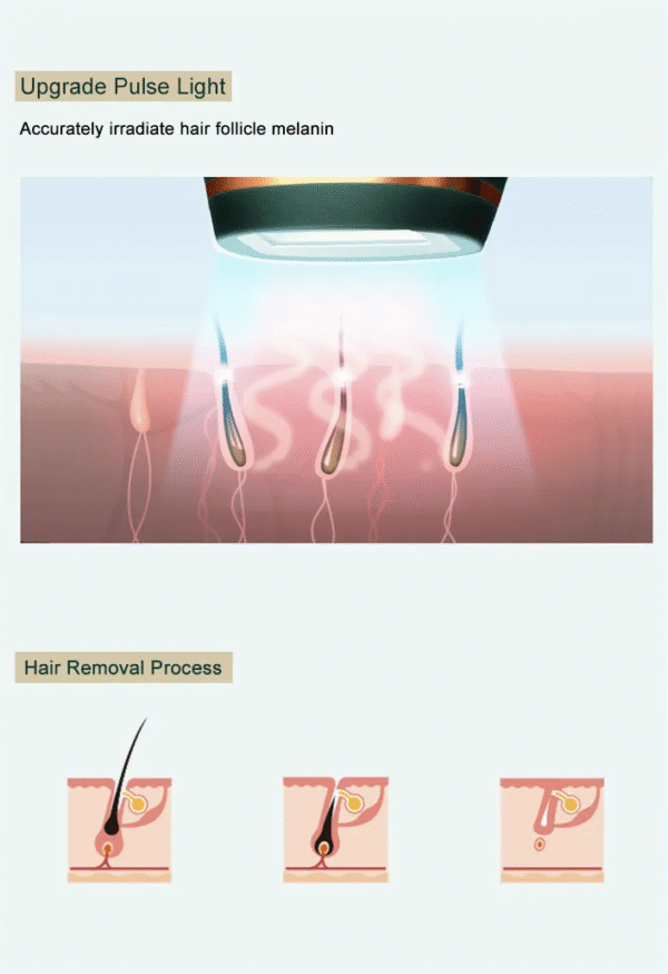 Permanent Painless Epilator Laser Portable Hair Remover IPL Hair Removal Device
